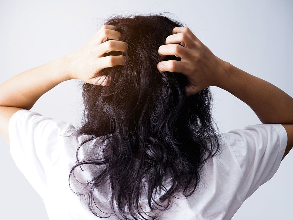 Quando considerare il trattamento per la perdita dei capelli?